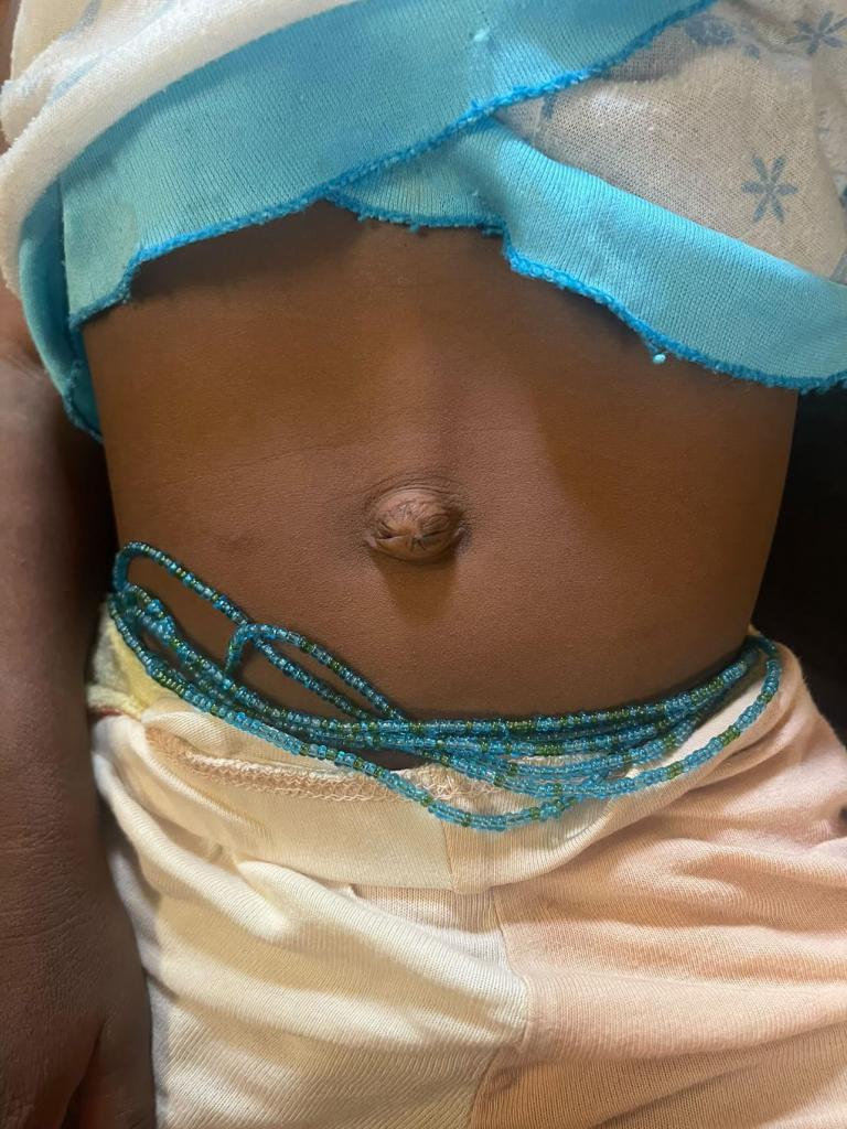So sieht ein Windelgürtel in Togo aus, Bild: (c) Elda Mupepe-Liebi